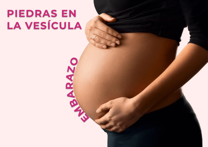 Piedras en la vesícula durante embarazo